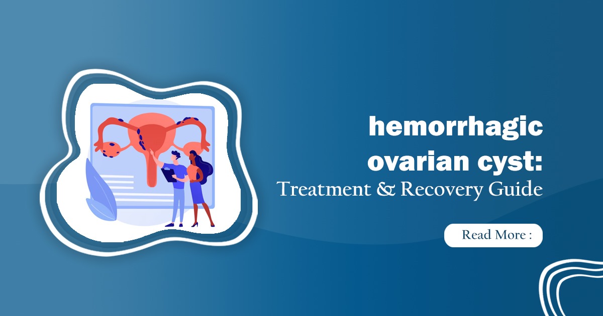 Hemorrhagic ovarian cyst - Know what is it from gynecologist?